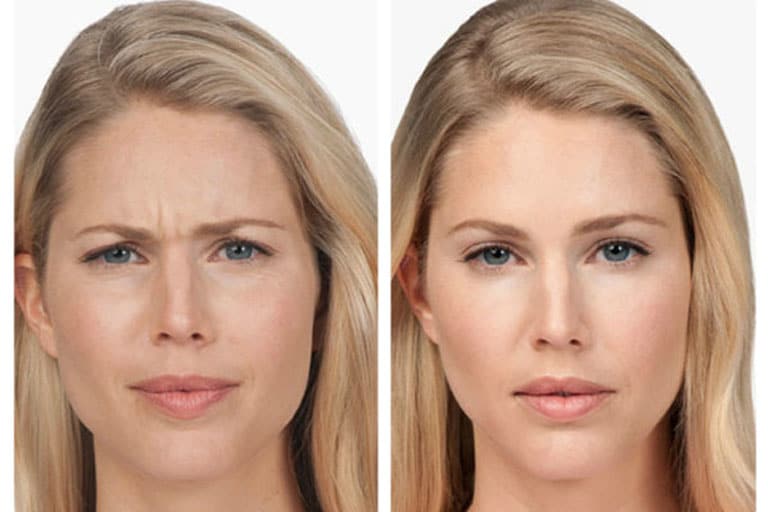 personalized skin treatment in Kenosha skin treatment in kenosha, customized skin care, southeast wisconsin aesthetics